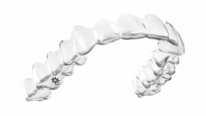 Invisalign® Clear Aligners